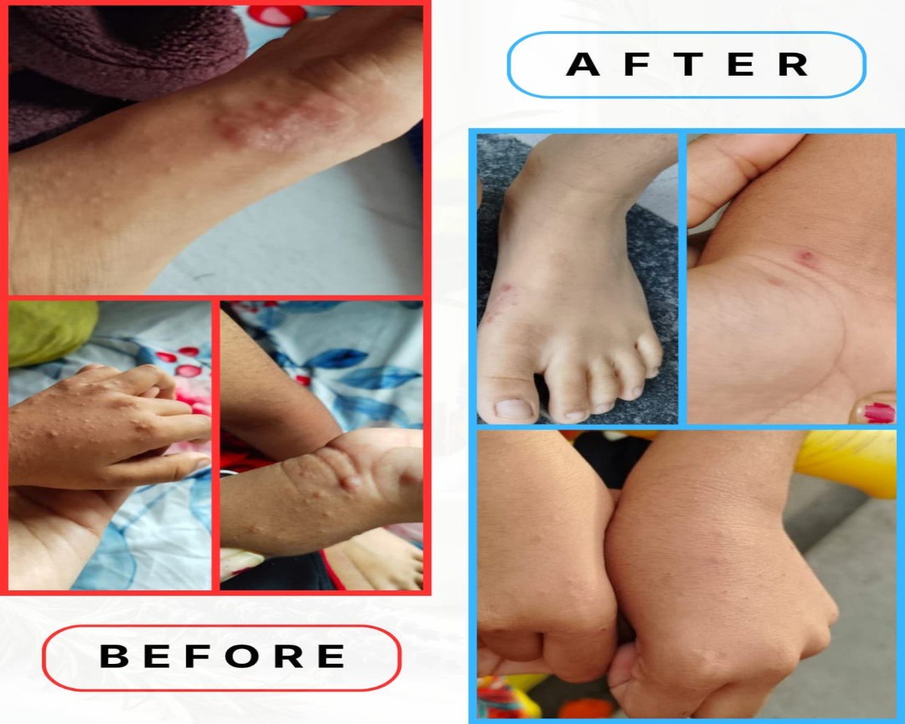 Significant improvement after homeopathic treatment